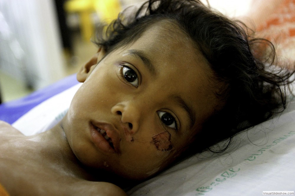 0044_zoriah-photojournalist-war-photographer_zoriah_photographer_tsunami_phuket_injured_injury_hospital_girl_thailand_asia_asian
